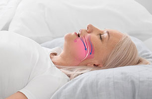 Sleep Apnea