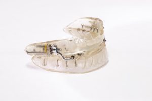 Mouthpiece For Snoring And Sleep Apnea