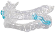 Clear dental oral appliance with blue connectors designed for sleep apnea treatment.