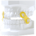 Dental sleep apnea oral appliance with yellow connectors on a teeth model