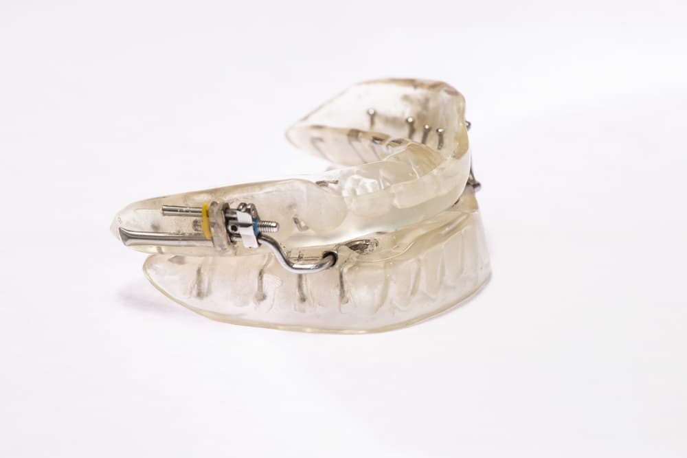 Oral appliance mouthpiece used for sleep apnea treatment on white background