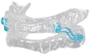 Clear dental oral appliance with blue connectors designed for sleep apnea treatment.