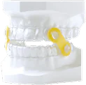 Dental sleep apnea oral appliance with yellow connectors on a teeth model